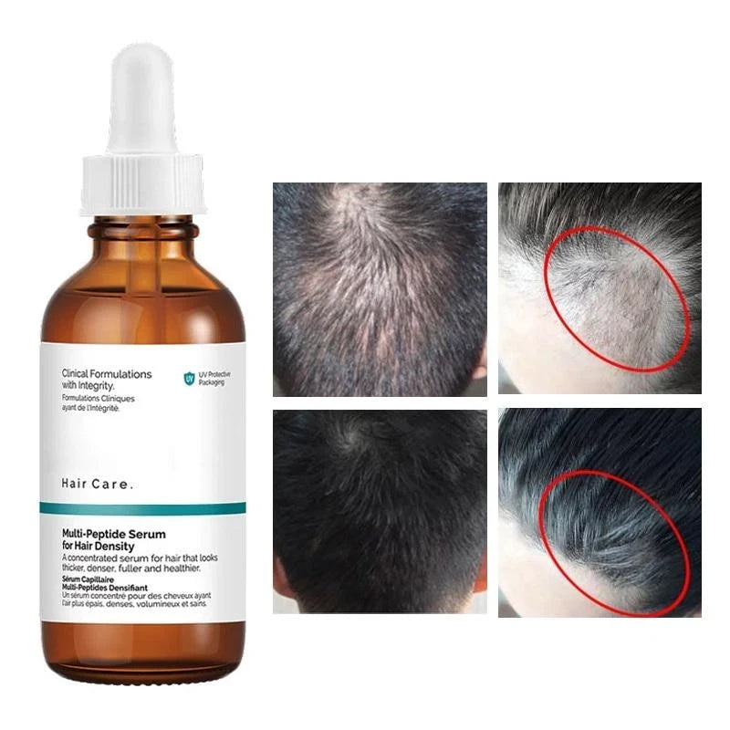 The Ordinary Multi-Peptide Hair Serum