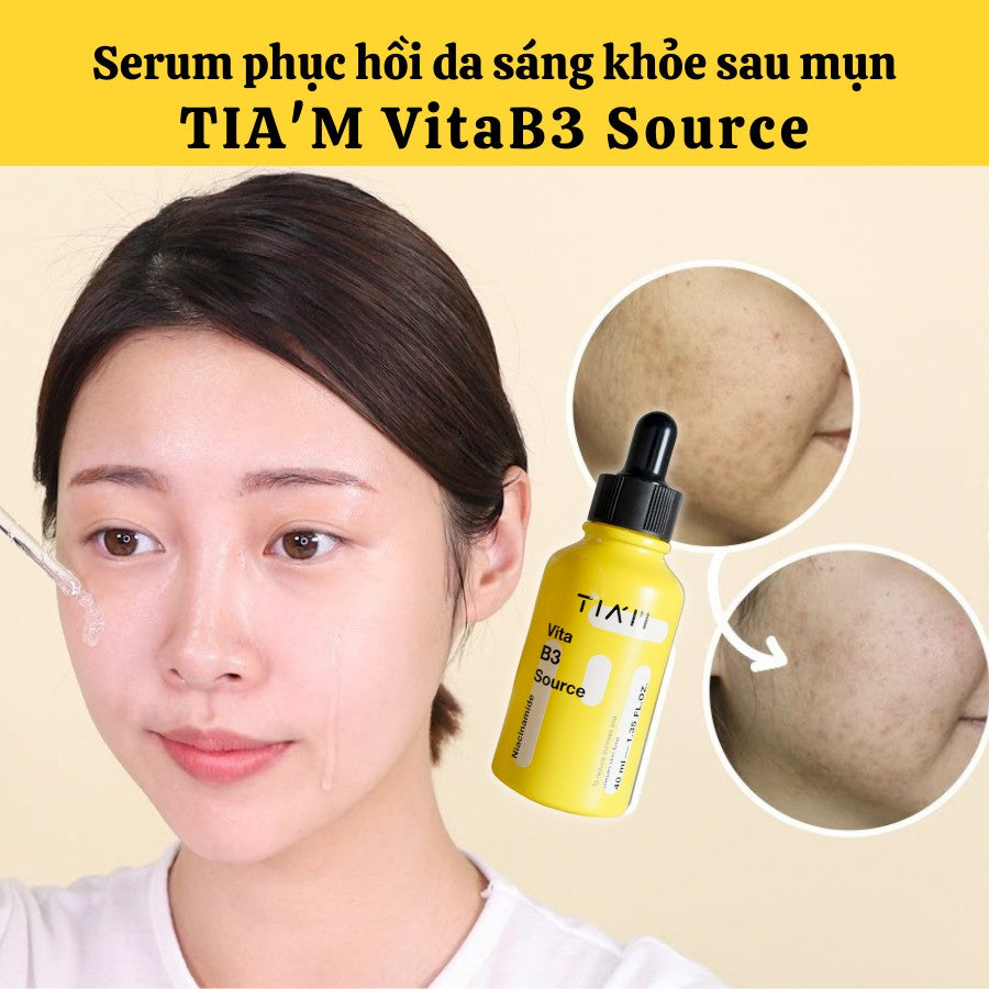 10% Niacinamide + 2% Arbutin-TIAM Vita B3 Source Serum