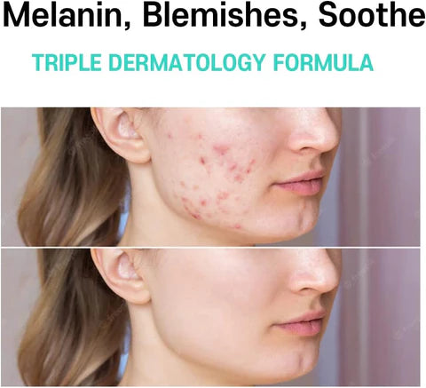 Laxzin Anti-Malasma Cica Cream
