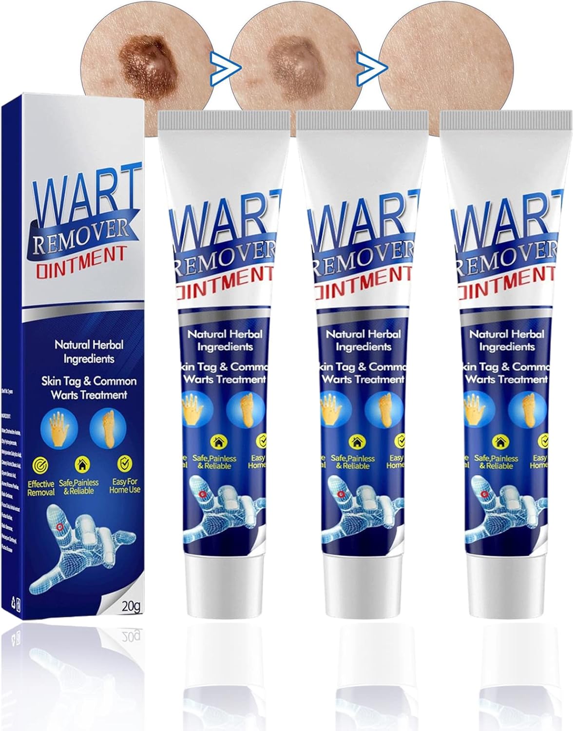 Wart Removing Pen-3pcs