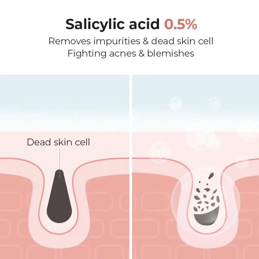 34% Discount-COSRX Cleanser Salicylic Acid