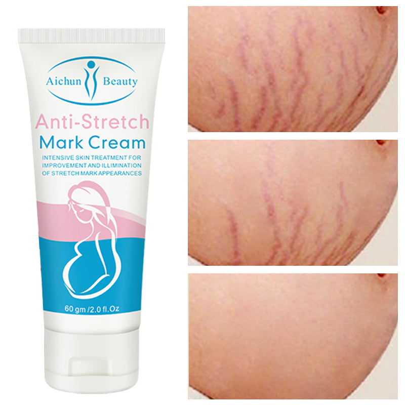 Anti-stretch Mark Cream