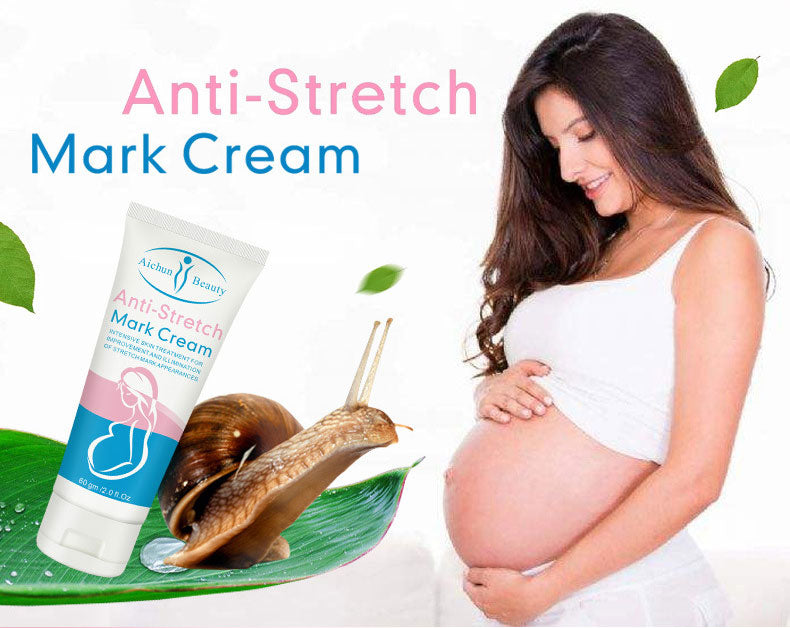 Anti-stretch Mark Cream
