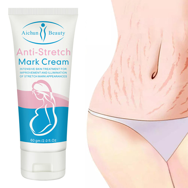 Anti-stretch Mark Cream