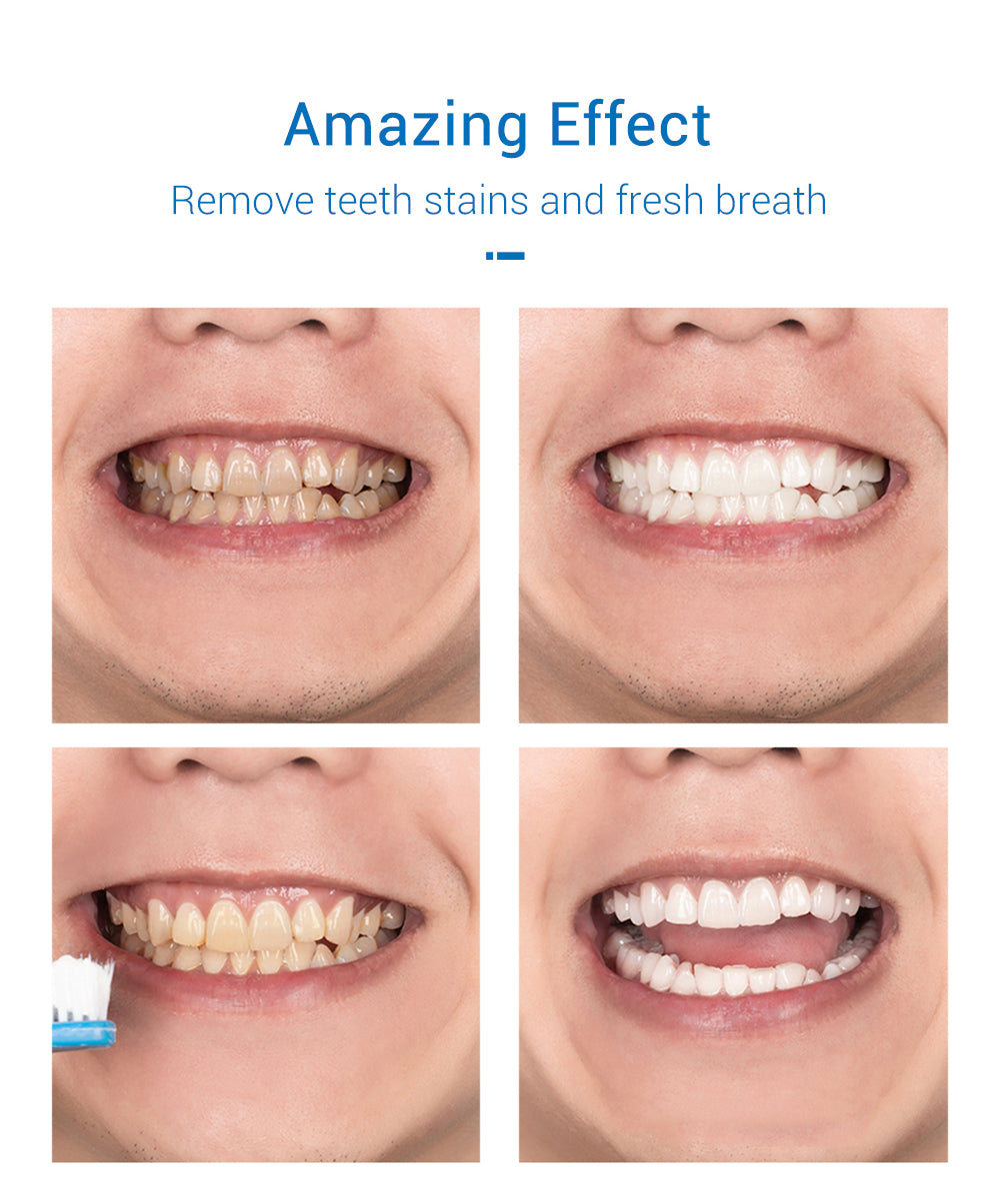 LANBENA Tooth-Cleaning Mousse Toothpaste