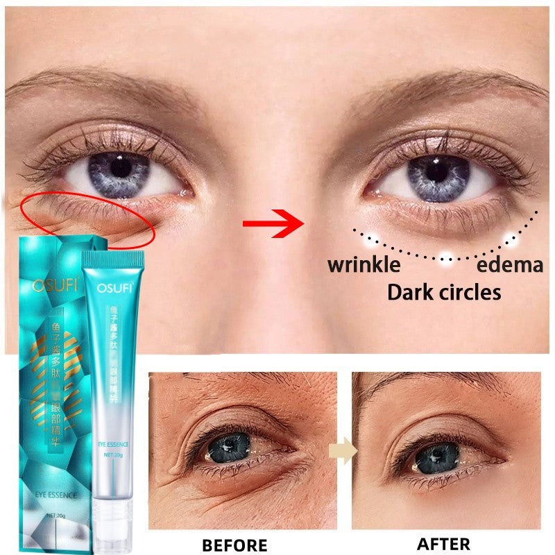 Anti-Wrinkle Eye Cream
