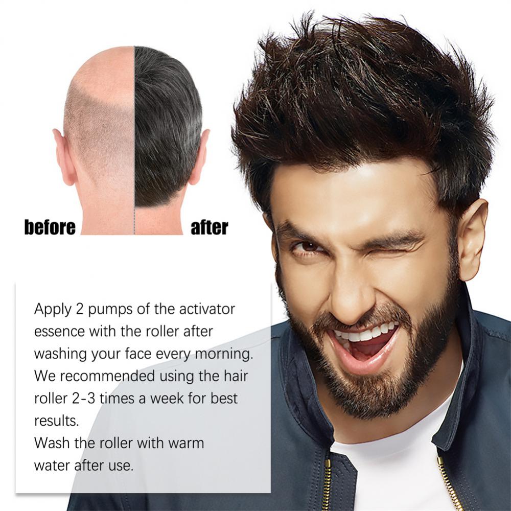 Derma Roller Microniddle Roller for Hair Growth