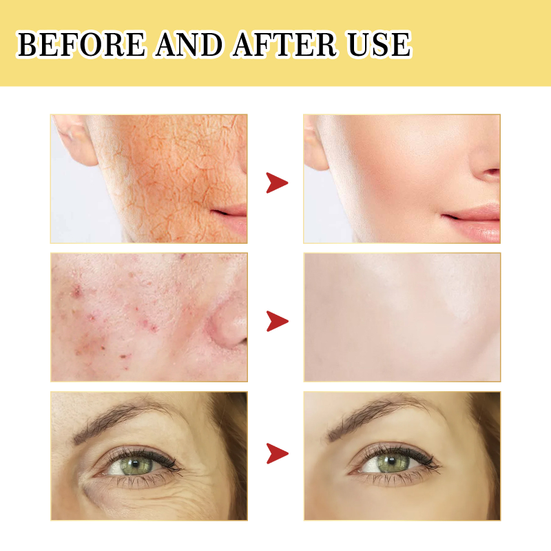 ৯৬% খাঁটি স্নেইল-OSRX Advanced Snail Mucin 96% Power Repairing Essence
