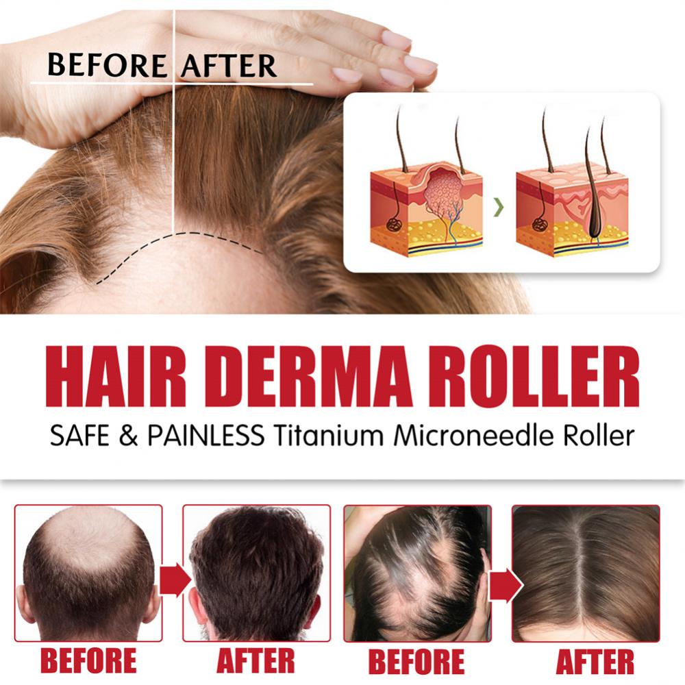 Derma Roller Microniddle Roller for Hair Growth