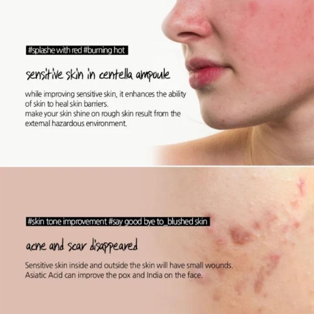 Korean Centella Asiatica Extract Moisturising-Golden Ampoule