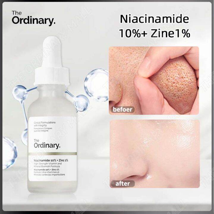The Ordinary Niacinamide 10% + Zinc 1% Anti-Blemish Serum