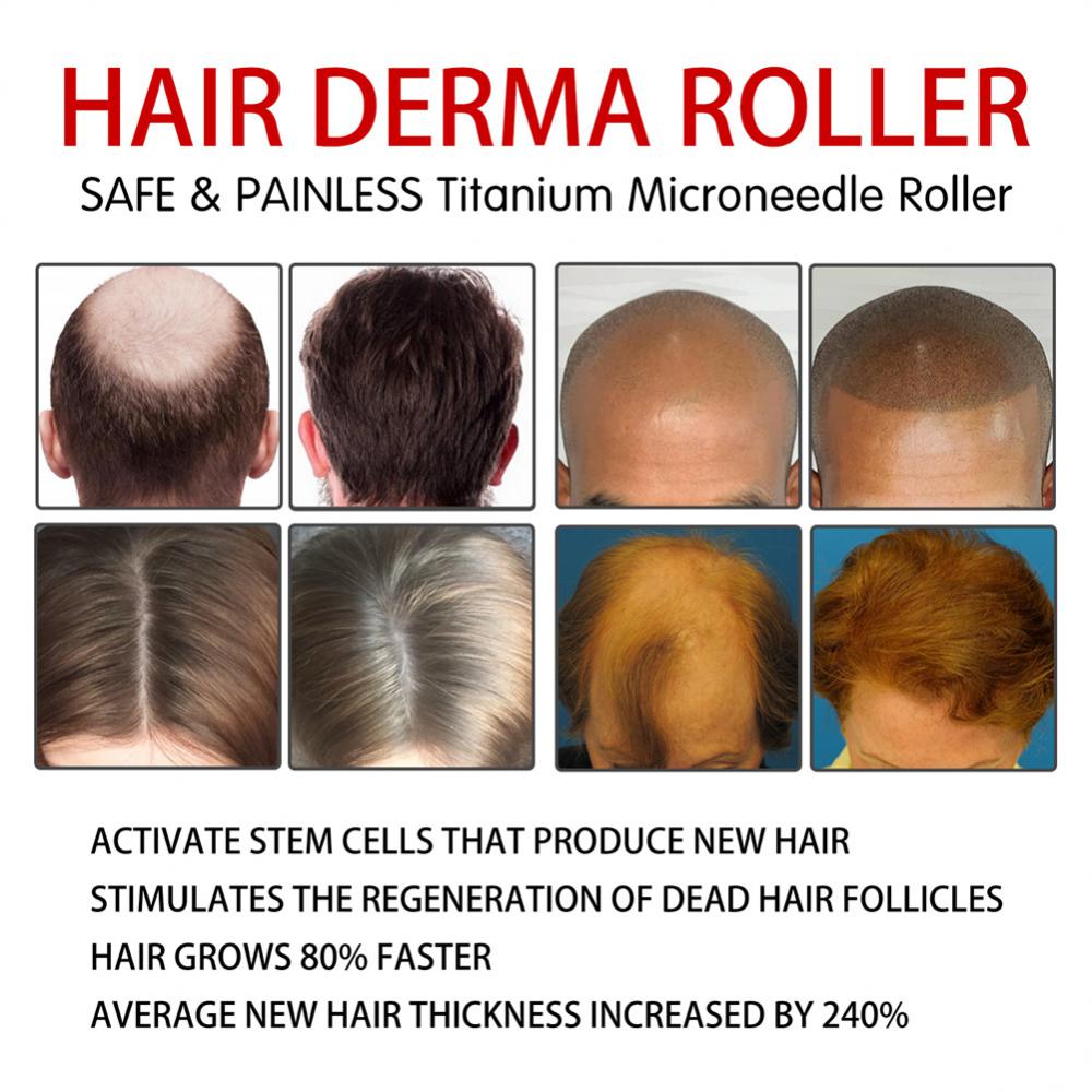 Derma Roller Microniddle Roller for Hair Growth