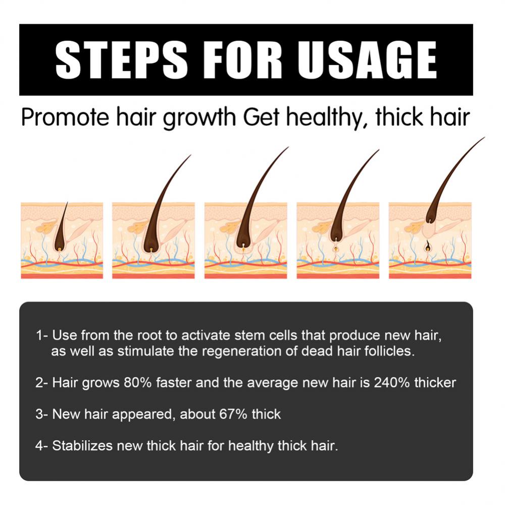 Derma Roller Microniddle Roller for Hair Growth