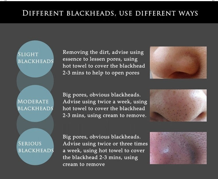 BIOAQUA Bamboo Charcoal Blackhead Remover
