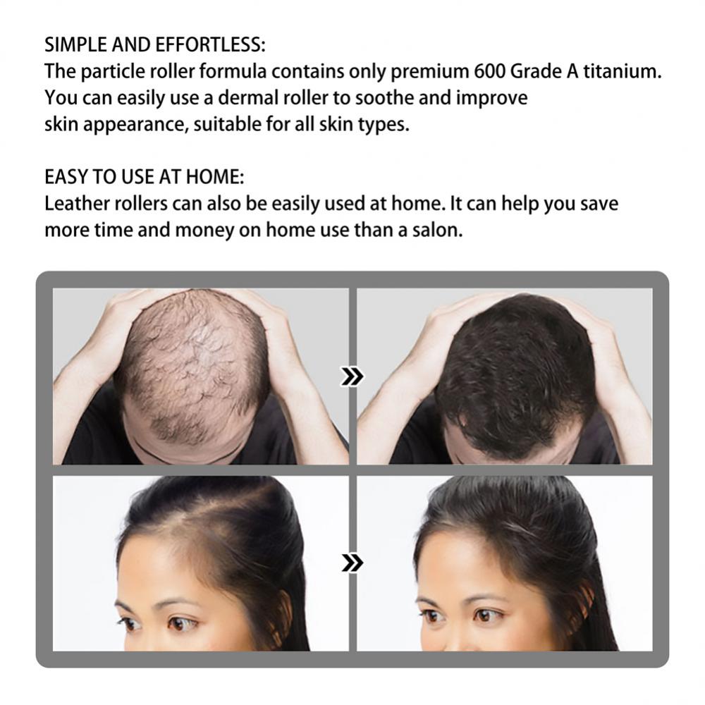 Derma Roller Microniddle Roller for Hair Growth