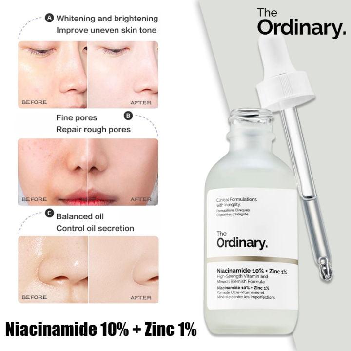 The Ordinary Niacinamide 10% + Zinc 1% Anti-Blemish Serum
