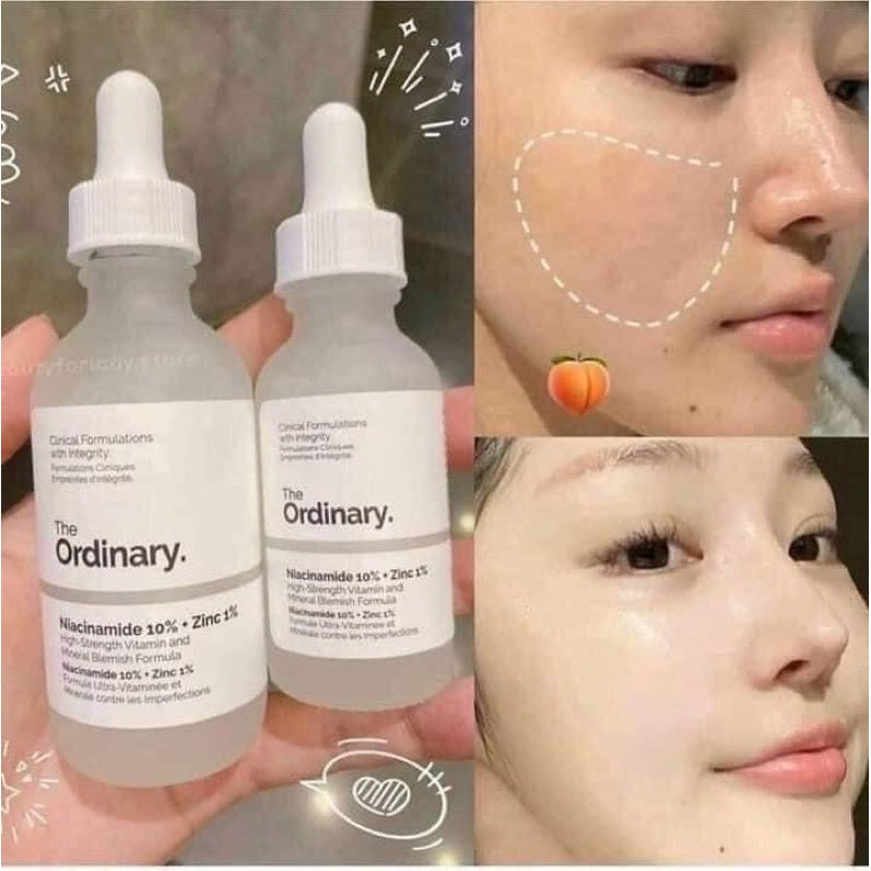 The Ordinary Niacinamide 10% + Zinc 1% Anti-Blemish Serum