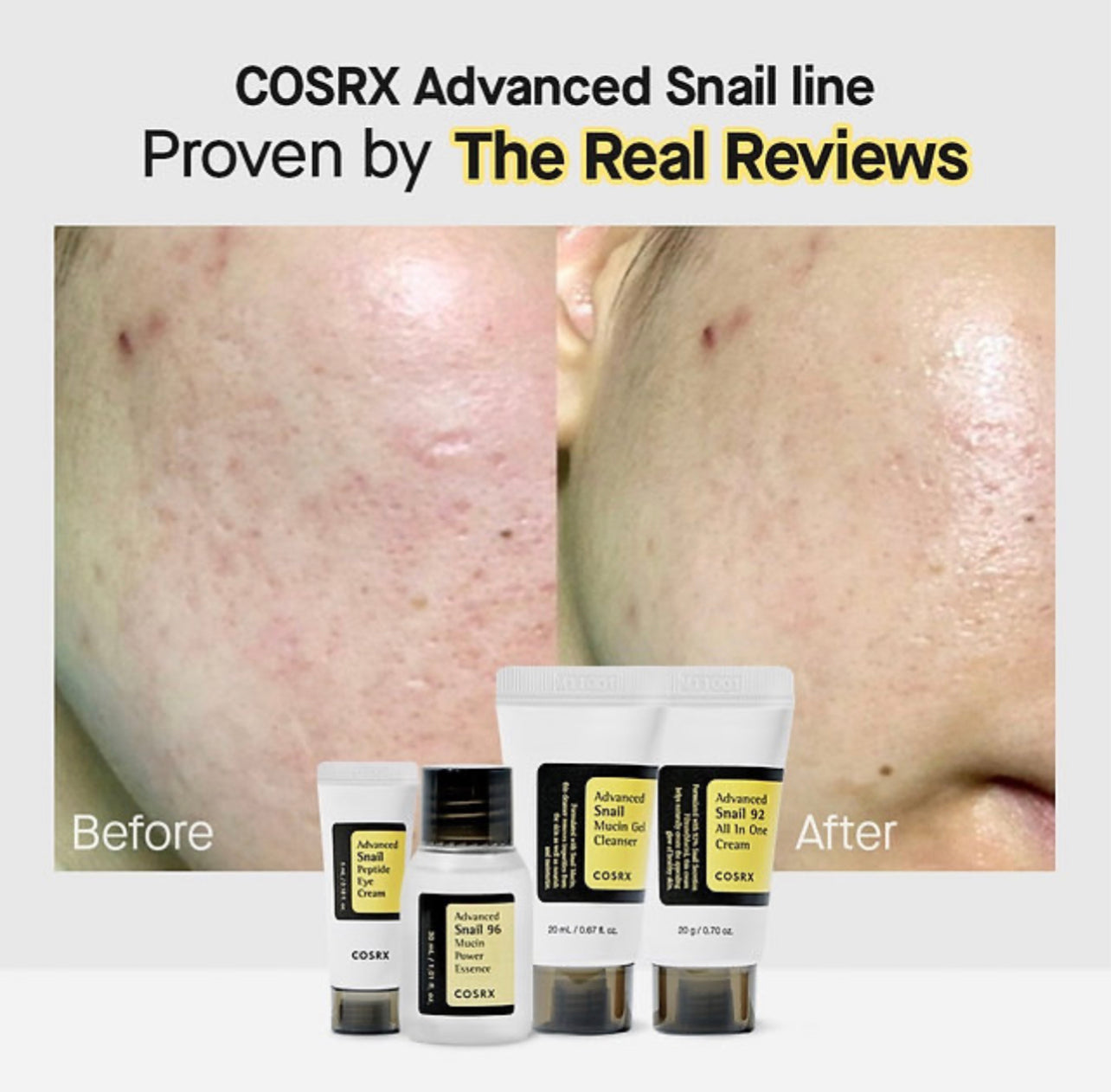 Cosrx All About Snail Kit(Gel Cleanser 20ml,Essence 30ml,Eye Cream 5ml & 92 Cream 20g)