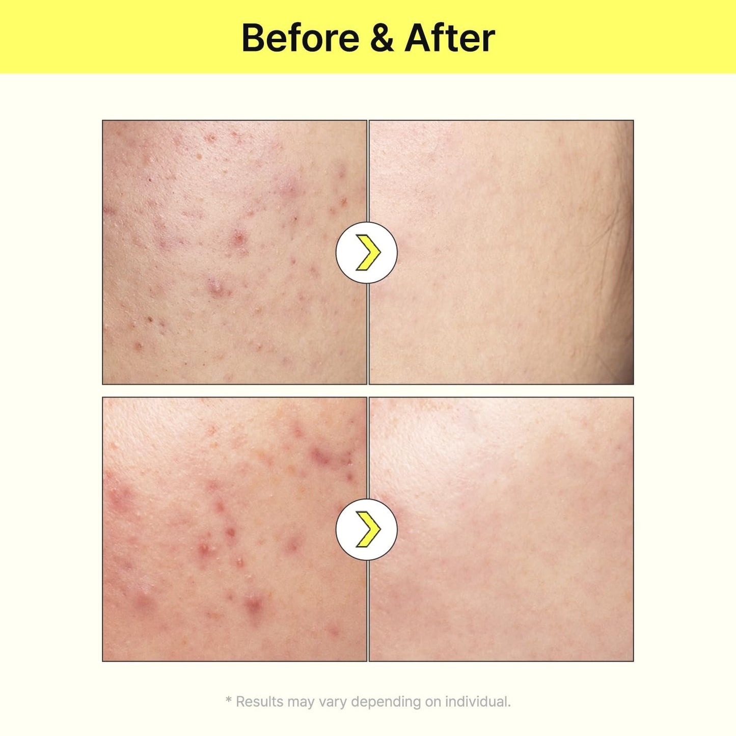 10% Niacinamide + 2% Arbutin-TIAM Vita B3 Source Serum