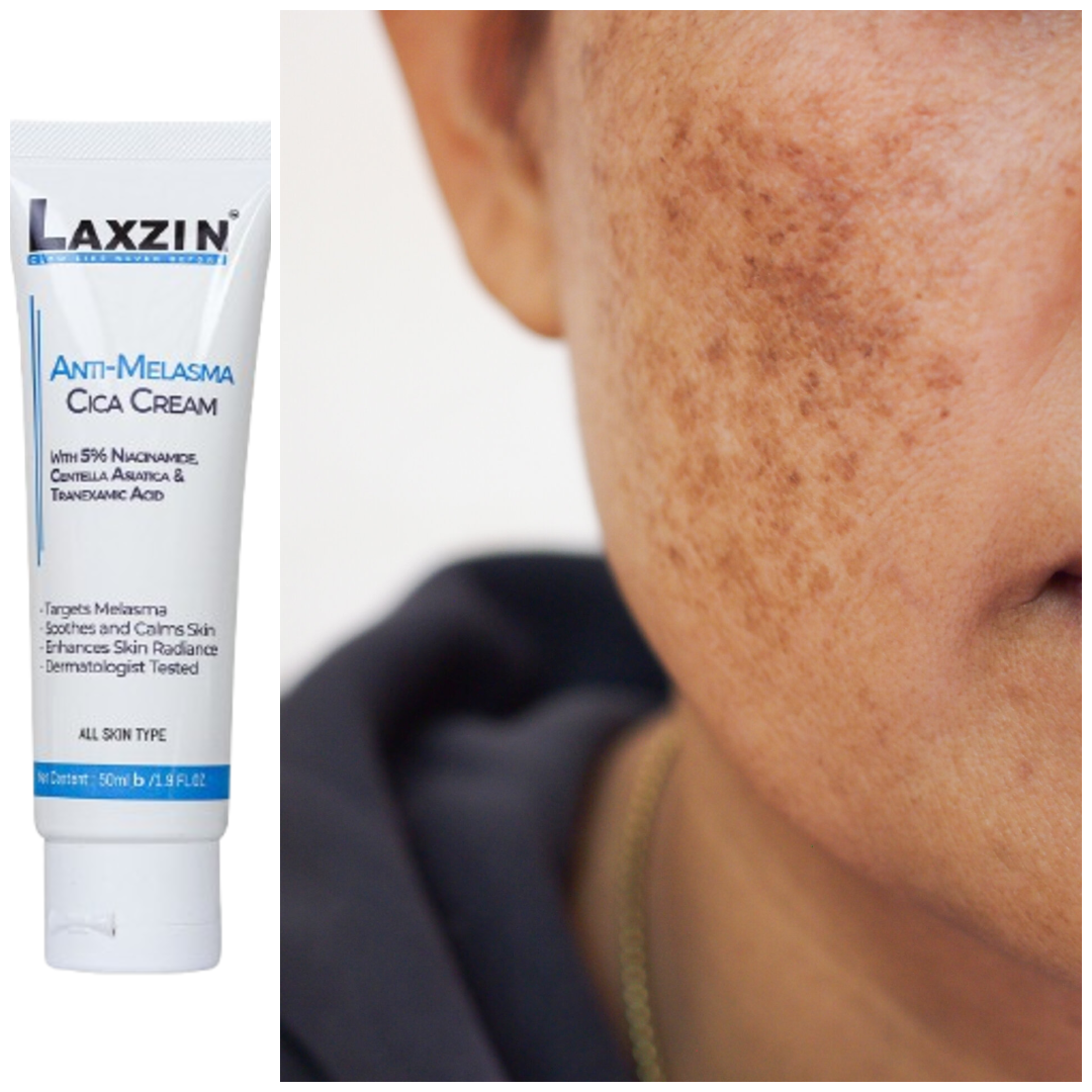 Laxzin Anti-Malasma Cica Cream