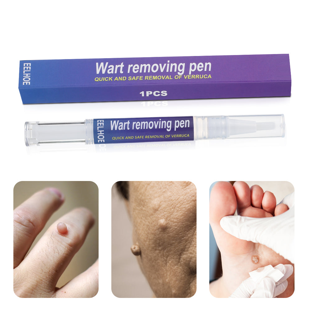 Wart Removing Pen