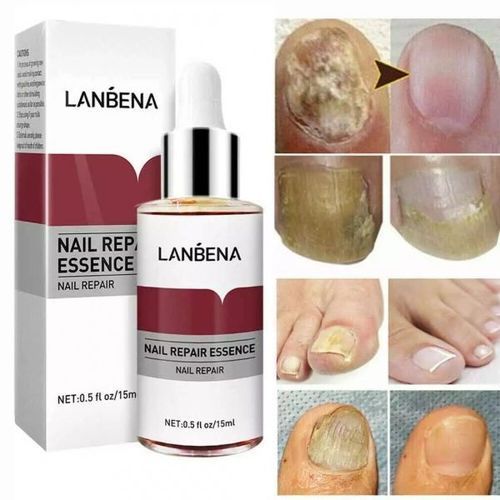 Lambina nail repair essence-2pcs