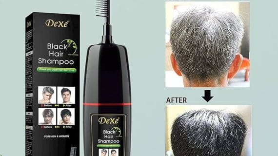 ( ২০০ML হার্বাল শেম্পু ) Dexe Fast Black Hair Shampoo