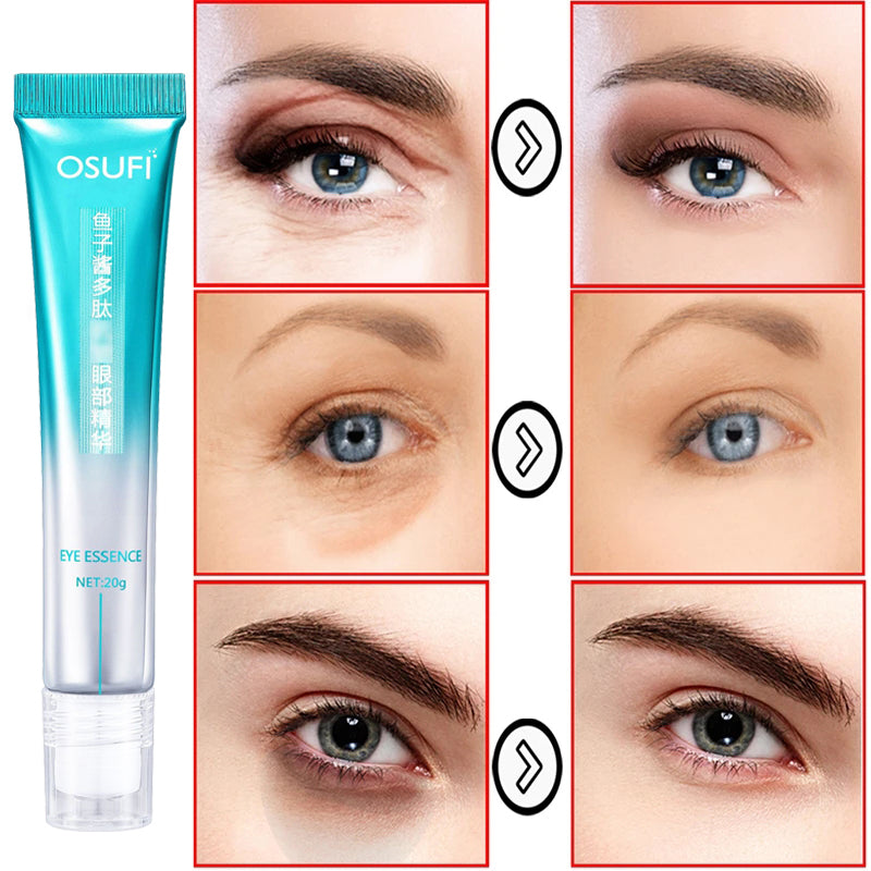 Anti-Wrinkle Eye Cream