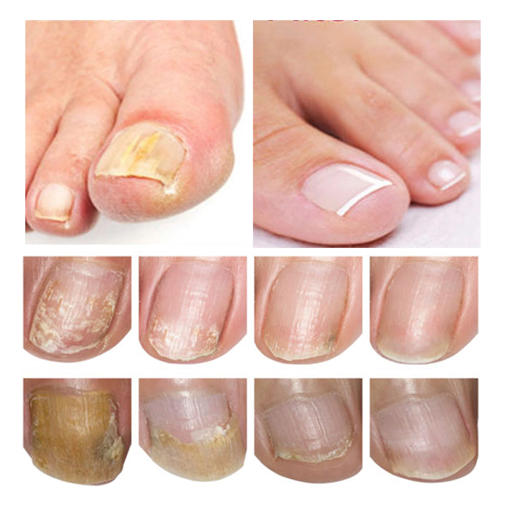 Lambina nail repair essence-1pcs