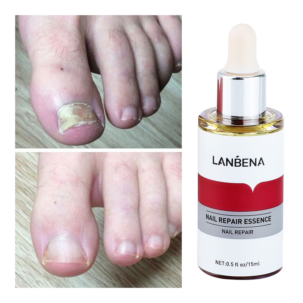 Lambina nail repair essence-2pcs