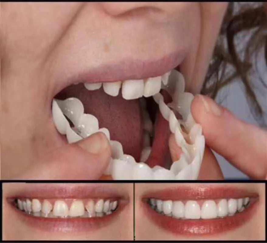 Adult Adjustable Dentures Teeth Set-1 pair