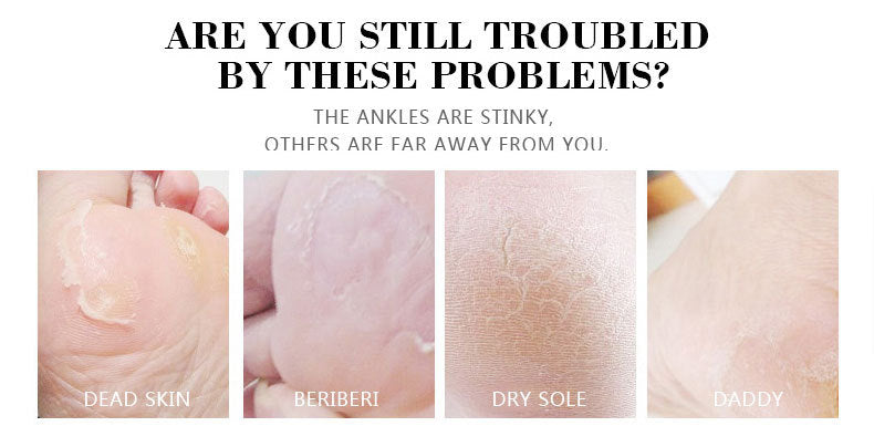 Banana &amp; Milk Extract Foot Cream!