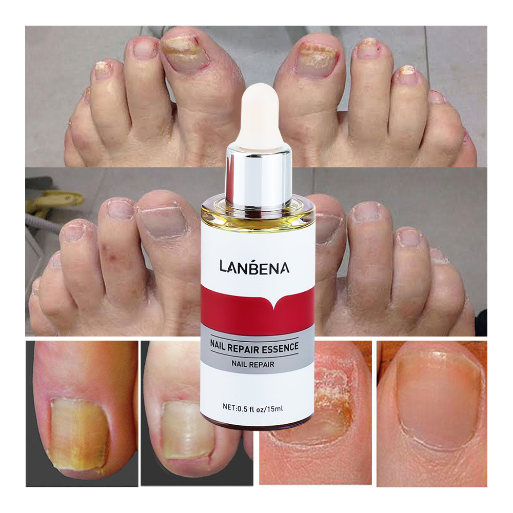 Lambina nail repair essence-2pcs