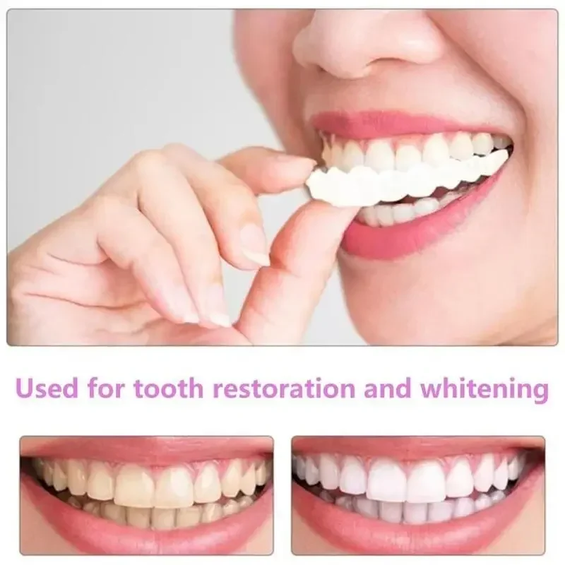 Adult Adjustable Dentures Teeth Set-1 pair