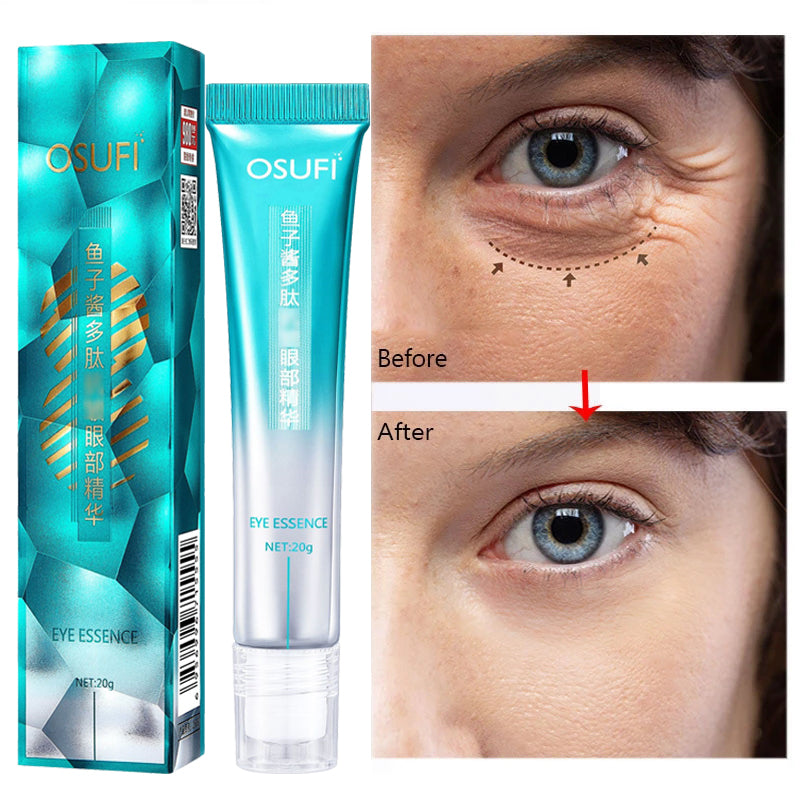 Anti-Wrinkle Eye Cream