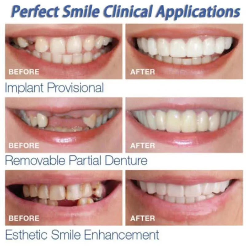 Adult Adjustable Dentures Teeth Set-1 pair