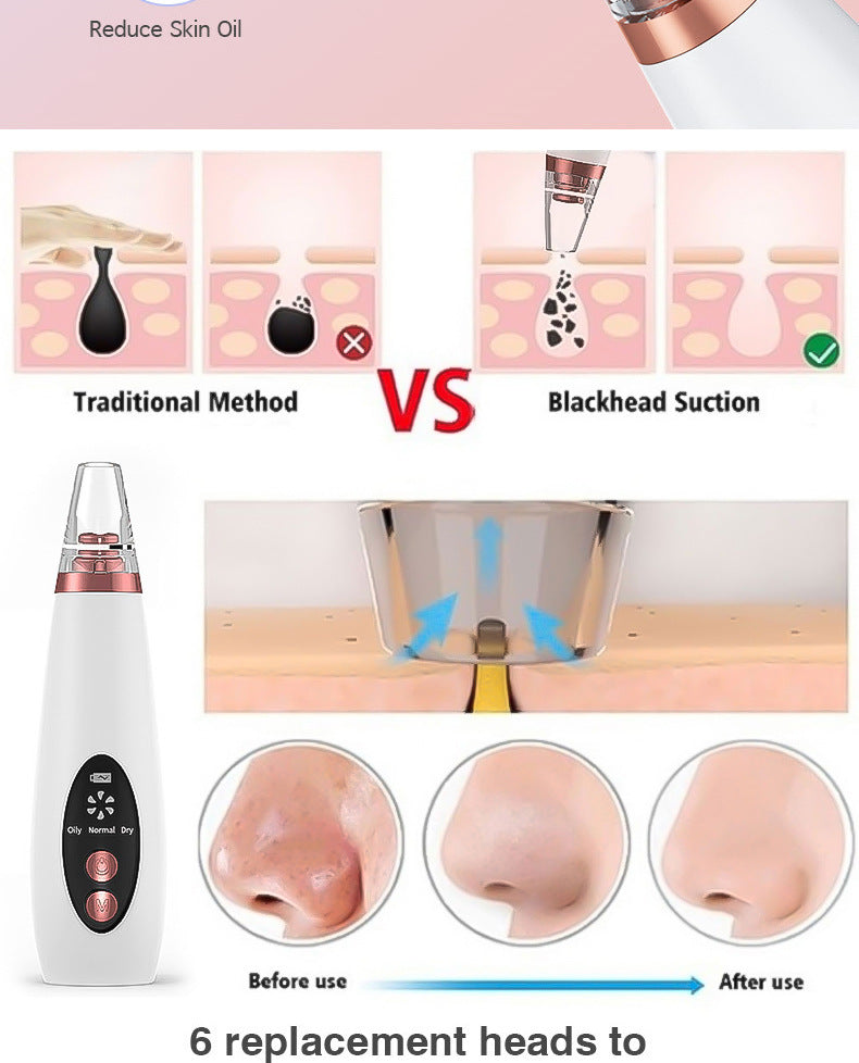 Electric Pore Blackhead Remover