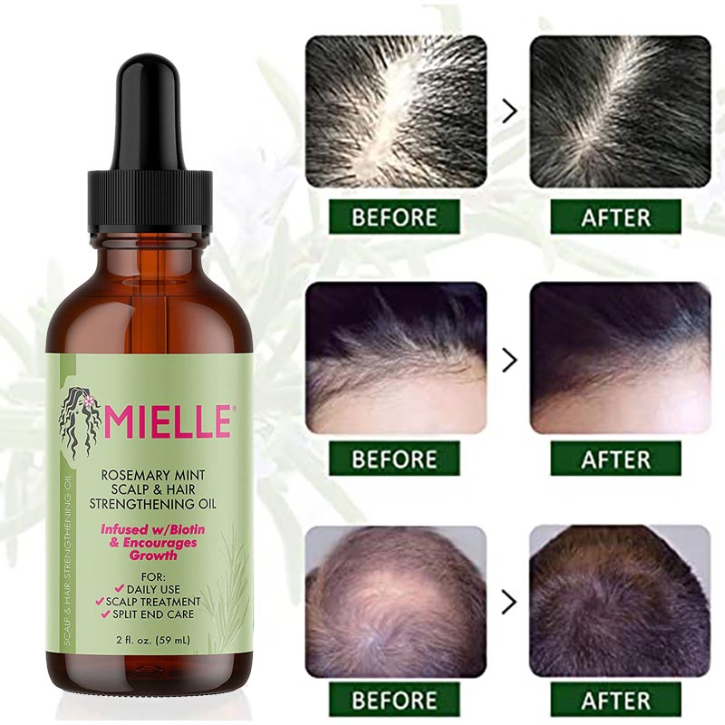 Mielle Rosemary Hair Growth Essential Oil