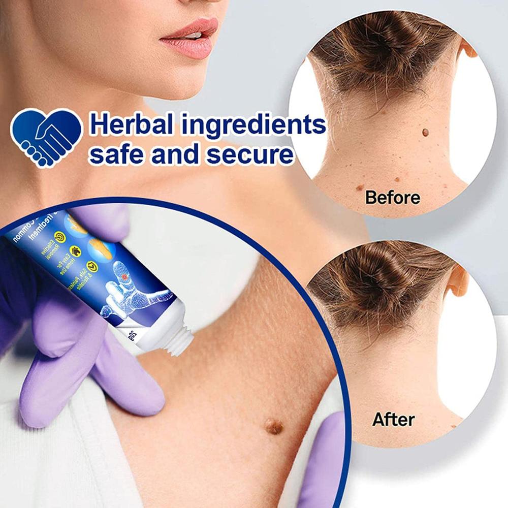Wart Removing Pen-3pcs