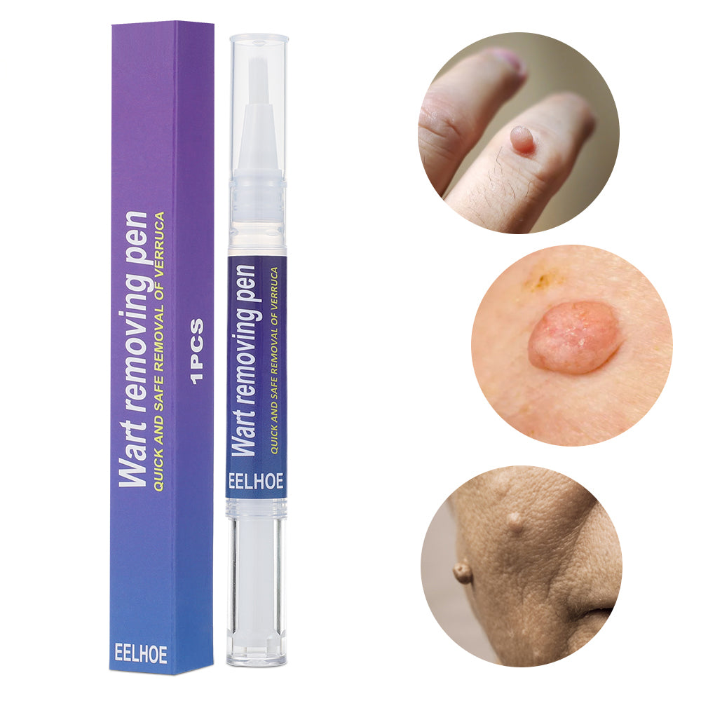 Wart Removing Pen