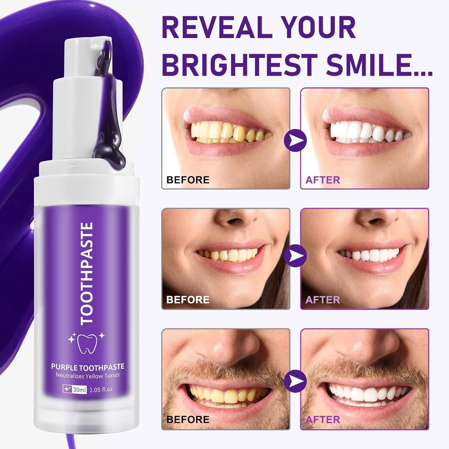 Purple Toothpaste – Teeth Whitening Colour Corrector Toothpaste