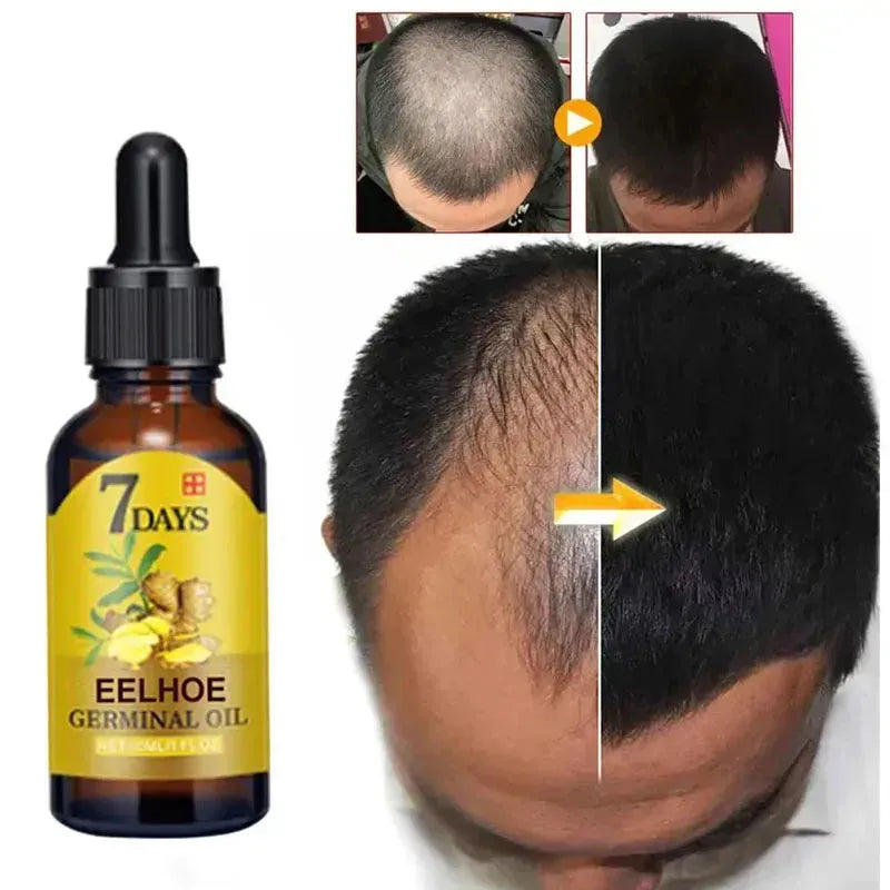 Thailend-Ginger Hair Growth Serum